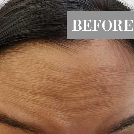 Before image