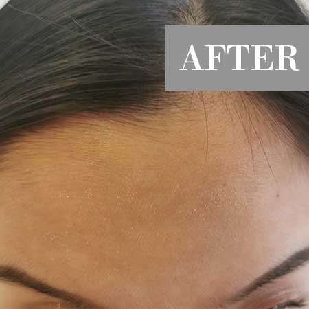 After image
