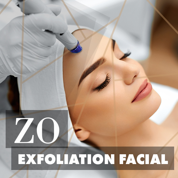 ZO-exfoliation
